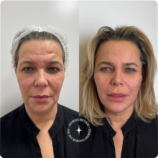 PHOTO-2025-05-11-22-46-03 2