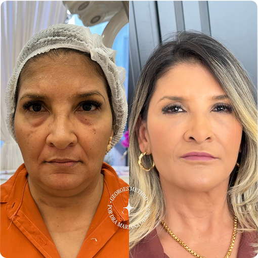 PHOTO-2025-05-11-22-46-03 3